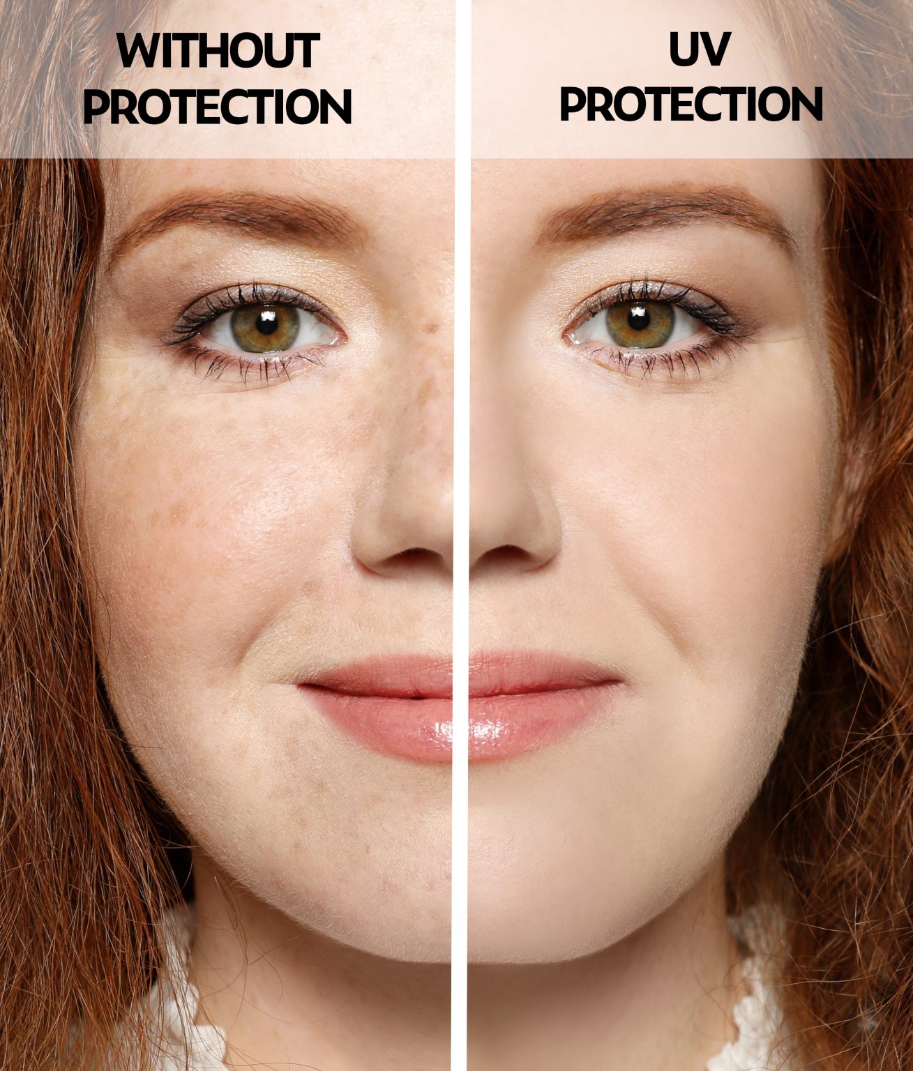 Young Woman Without And With Sun Protection Cream On Her Face, C
